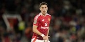 Waduh, Satu Lagi Pemain Manchester United Tumbang Akibat Cedera?