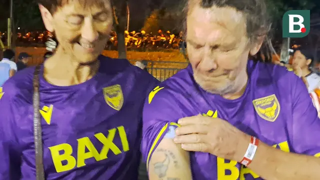 Penggemar Oxford United, Ross Claerk, memperlihatkan tato logo klub berjulukan The U's itu saat berada di area Stadion Si Jalak Harupat, Soreang, Bandung, Sabtu (12/7/2025). Ross Claerk dan istrinya, Sally, datang ke Indonesia untuk mengikuti tur pramusim Oxford United yang tampil di Piala Presiden 2025. (Bola.com/Muhammad Adi Yaksa)